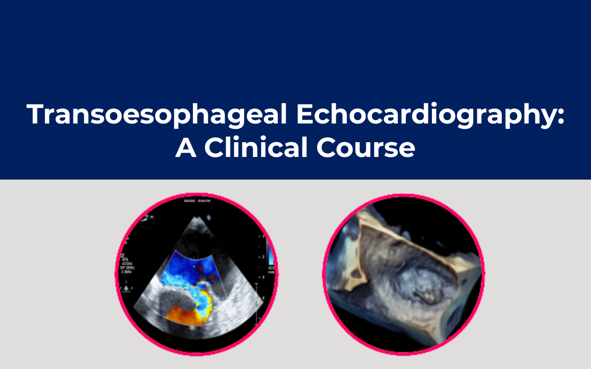 Transoesophageal Echocardiography: A Clinical Course