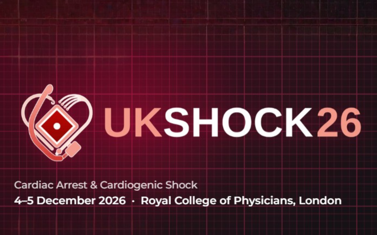 UK Shock 2026