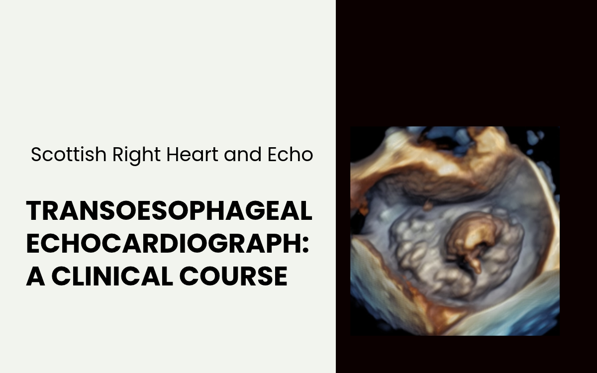 Transoesophageal Echocardiography: A Clinical Course