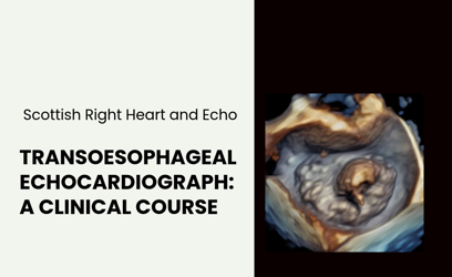 Transoesophageal Echocardiography: A Clinical Course